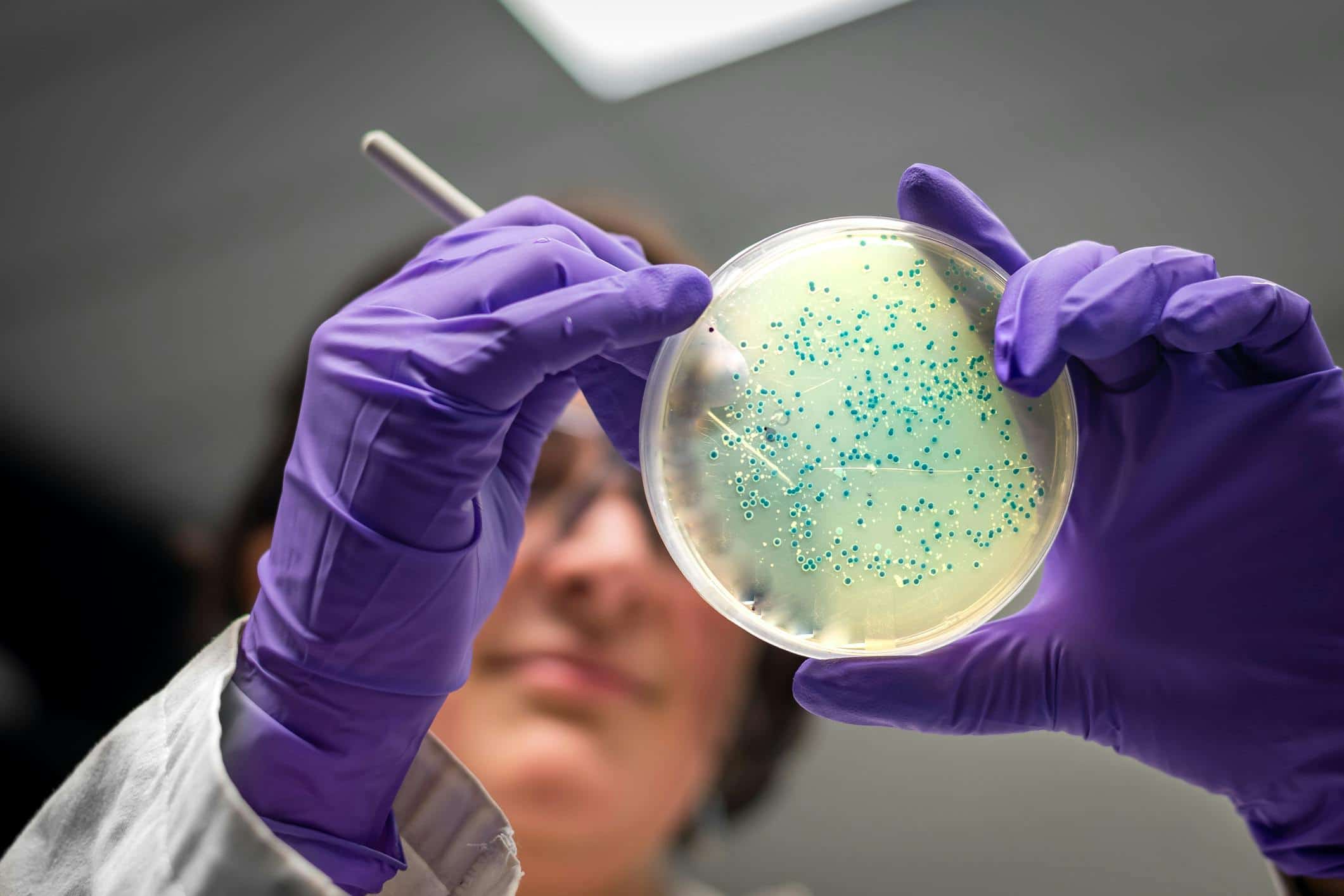 A scientist wearing purple gloves holds a petri dish with blue bacterial colonies for examination. The dish is held up to the light, highlighting the detailed bacterial growth pattern on the agar surface.